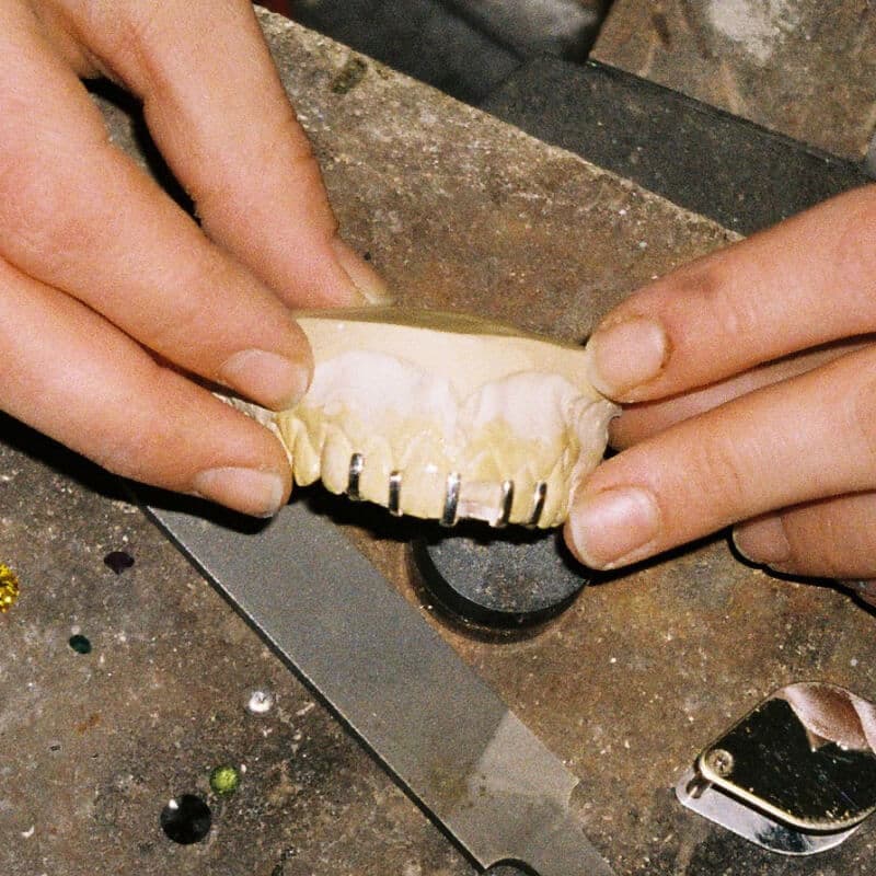 Finální odlití a zhotovení grillz