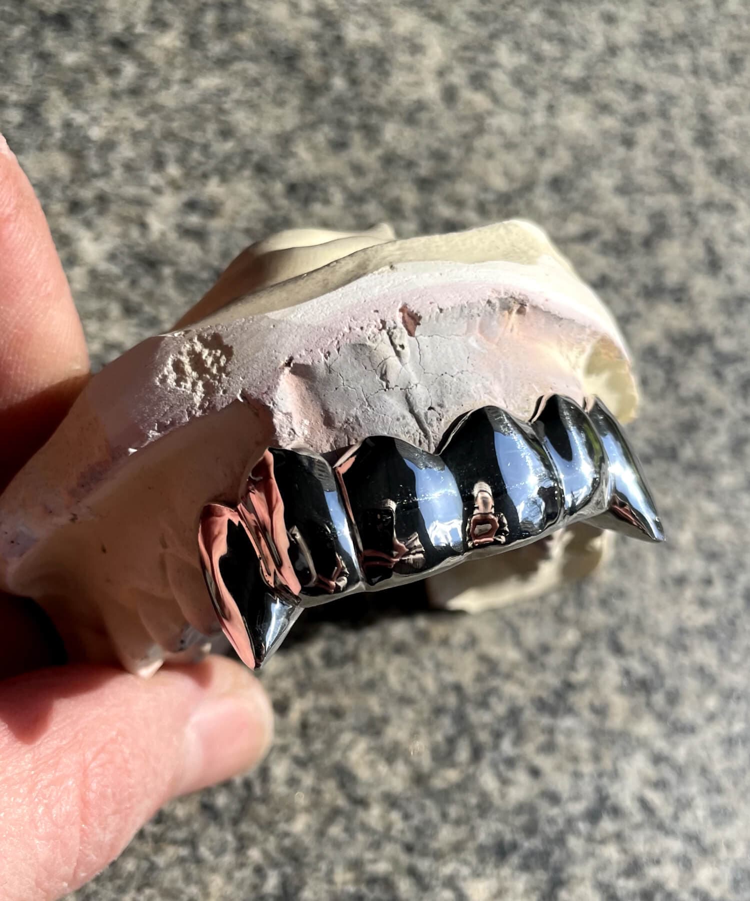 Silver vampire grillz