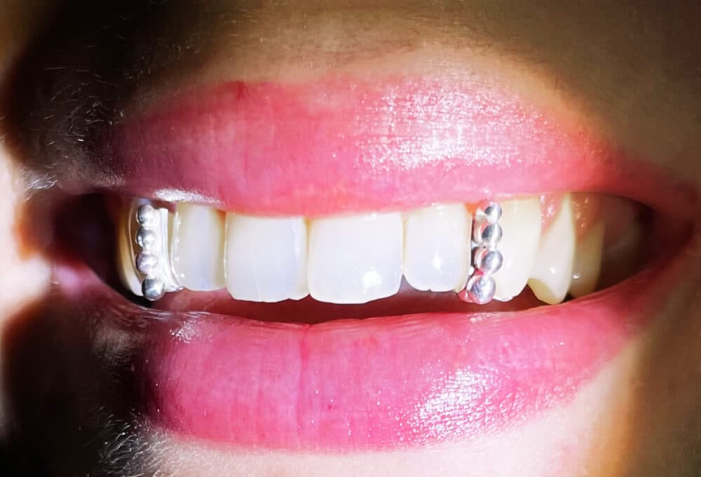 Custom Jewelry Header Image 2